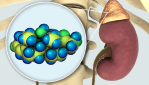 Adrenals and Cortisol